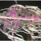 This image shows the Northern root-knot nematode, Meloidogyne hapla, infecting bean roots. The red-stained structures are female nematodes. (Image credit: Pallavi Shakya)